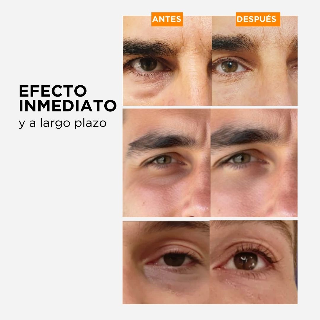 Contorno de Ojos para Hombres Hangover Power | Anti-Ojeras Beardburys Essentials