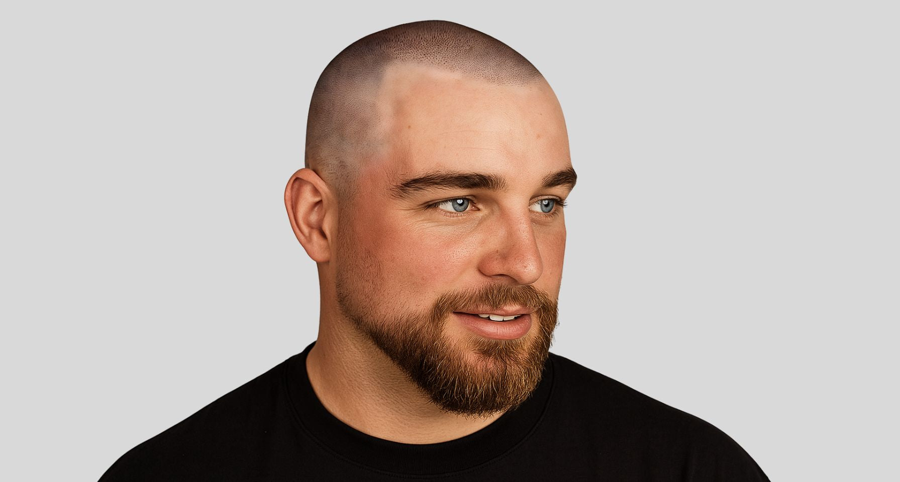 hombre calvos con barba en trendencia